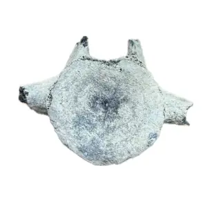 Vertebrae